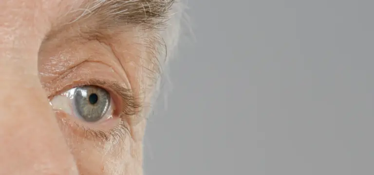 Glaucoma: Ladrón de la visión y 3 formas de detectarlo